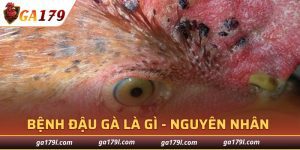 Bệnh Đậu Gà