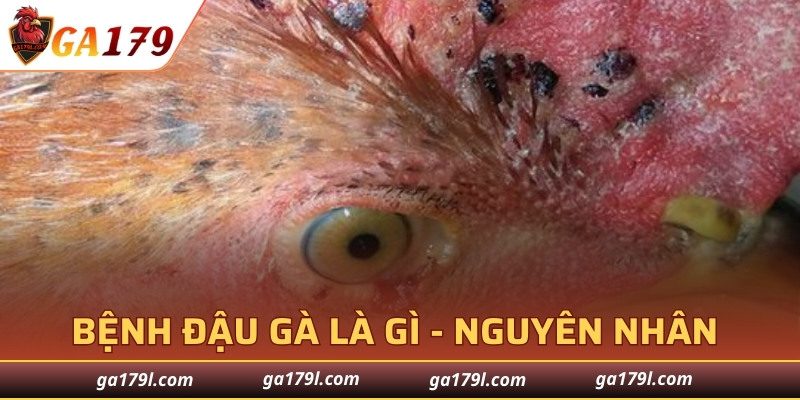 Bệnh Đậu Gà