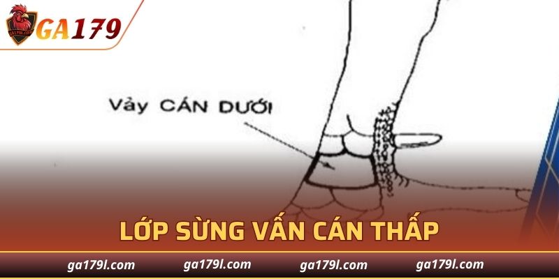 Cách nhận diện lớp sừng Vấn Cán thấp đơn giản