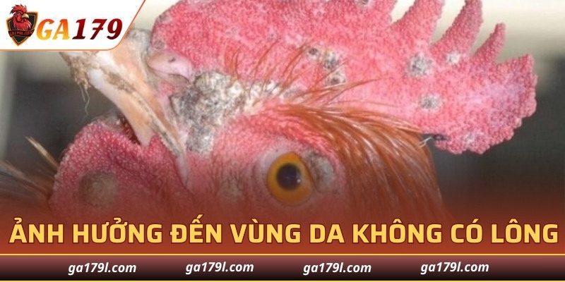 Thể ngoài da ảnh hưởng đến vùng da không có lông