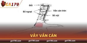 Vảy Vấn Cán